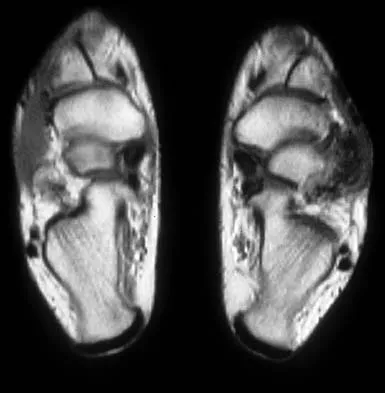 General Orthopedics Board Review 2026: High-Yield MCQs (Set 14) - Figure 6