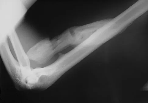 General Orthopedics Board Review 2026: High-Yield MCQs (Set 14) - Figure 63