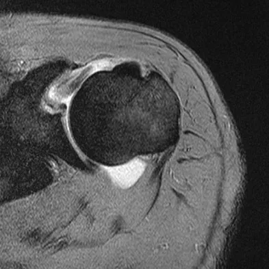 General Orthopedics Board Review 2026: High-Yield MCQs (Set 14) - Figure 64