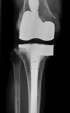 General Orthopedics Board Review 2026: High-Yield MCQs (Set 14) - Figure 73