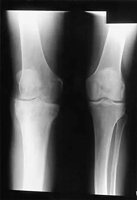 General Orthopedics Board Review 2026: High-Yield MCQs (Set 14) - Figure 75