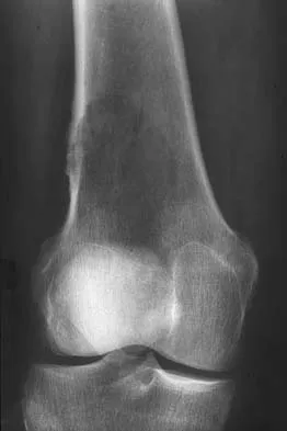 General Orthopedics Board Review 2026: High-Yield MCQs (Set 14) - Figure 84