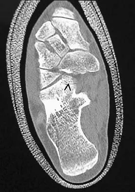 General Orthopedics Board Review 2026: High-Yield MCQs (Set 14) - Figure 86