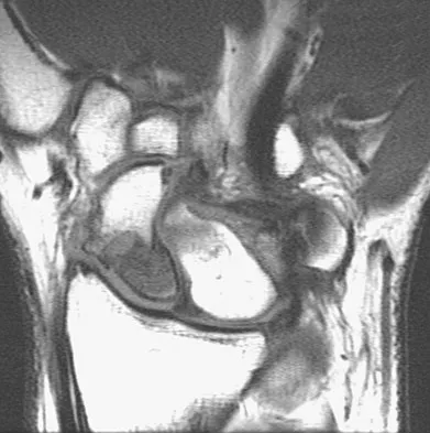 General Orthopedics Board Review 2026: High-Yield MCQs (Set 14) - Figure 88