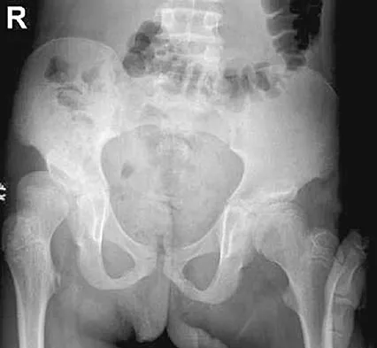 General Orthopedics Board Review 2026: High-Yield MCQs (Set 14) - Figure 91