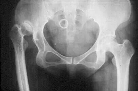 General Orthopedics Board Review 2026: High-Yield MCQs (Set 14) - Figure 94