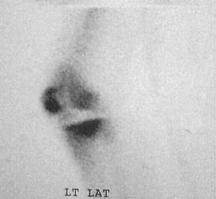 General Orthopedics 2026 Practice Questions: Set 15 (Solved) - Figure 100