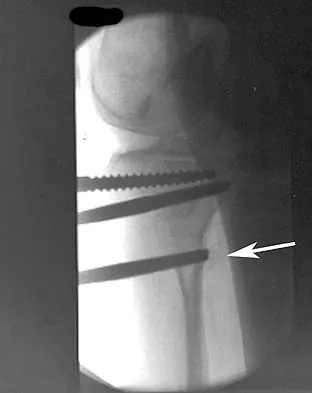 General Orthopedics 2026 Practice Questions: Set 15 (Solved) - Figure 103