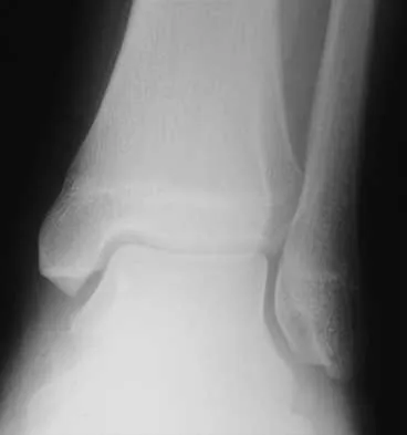 General Orthopedics 2026 Practice Questions: Set 15 (Solved) - Figure 105
