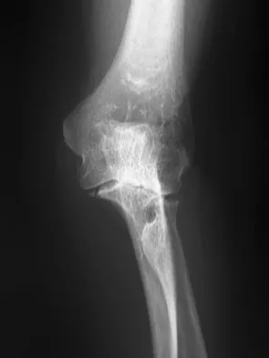 General Orthopedics 2026 Practice Questions: Set 15 (Solved) - Figure 107