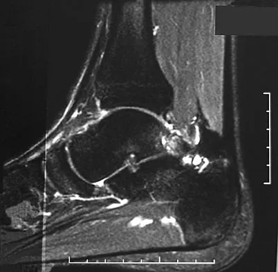 General Orthopedics 2026 Practice Questions: Set 15 (Solved) - Figure 110