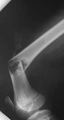 General Orthopedics 2026 Practice Questions: Set 15 (Solved) - Figure 113