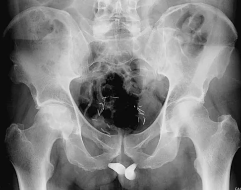 General Orthopedics 2026 Practice Questions: Set 15 (Solved) - Figure 114