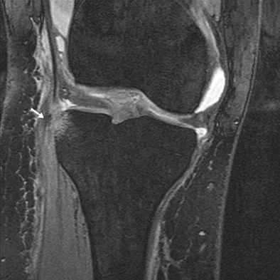 General Orthopedics 2026 Practice Questions: Set 15 (Solved) - Figure 117