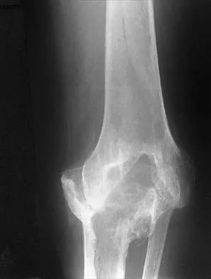 General Orthopedics 2026 Practice Questions: Set 15 (Solved) - Figure 121