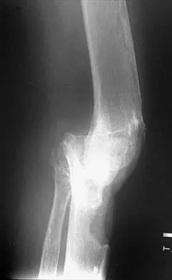 General Orthopedics 2026 Practice Questions: Set 15 (Solved) - Figure 122