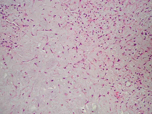General Orthopedics 2026 Practice Questions: Set 15 (Solved) - Figure 127