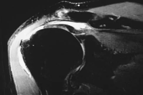 General Orthopedics 2026 Practice Questions: Set 15 (Solved) - Figure 128