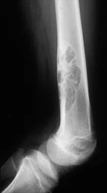 General Orthopedics 2026 Practice Questions: Set 15 (Solved) - Figure 130