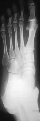 General Orthopedics 2026 Practice Questions: Set 15 (Solved) - Figure 131