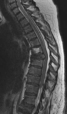 General Orthopedics 2026 Practice Questions: Set 15 (Solved) - Figure 19