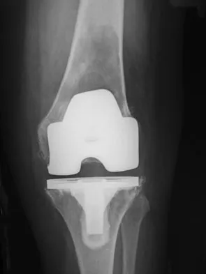 General Orthopedics 2026 Practice Questions: Set 15 (Solved) - Figure 2