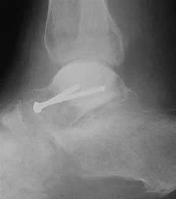 General Orthopedics 2026 Practice Questions: Set 15 (Solved) - Figure 22