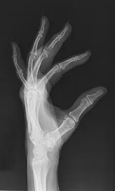 General Orthopedics 2026 Practice Questions: Set 15 (Solved) - Figure 25