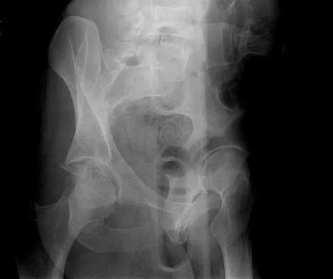 General Orthopedics 2026 Practice Questions: Set 15 (Solved) - Figure 28
