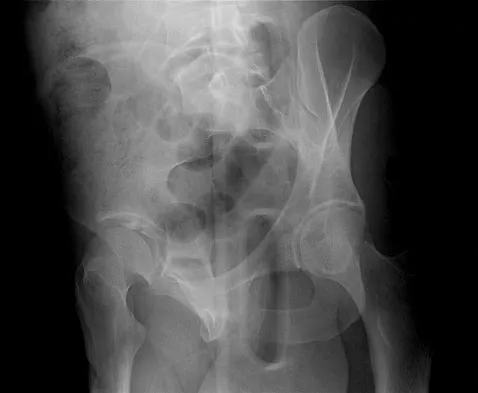 General Orthopedics 2026 Practice Questions: Set 15 (Solved) - Figure 29