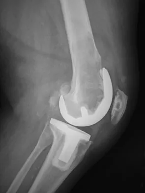 General Orthopedics 2026 Practice Questions: Set 15 (Solved) - Figure 3