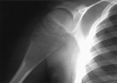 General Orthopedics 2026 Practice Questions: Set 15 (Solved) - Figure 30