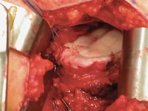 General Orthopedics 2026 Practice Questions: Set 15 (Solved) - Figure 36