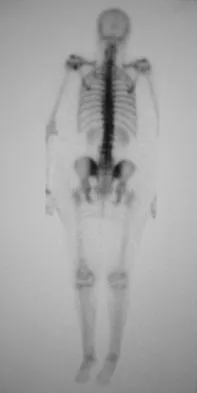 General Orthopedics 2026 Practice Questions: Set 15 (Solved) - Figure 4