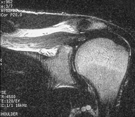 General Orthopedics 2026 Practice Questions: Set 15 (Solved) - Figure 48