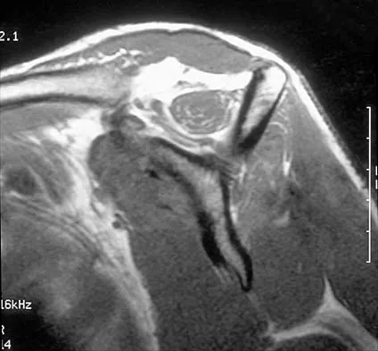 General Orthopedics 2026 Practice Questions: Set 15 (Solved) - Figure 49