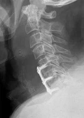 General Orthopedics 2026 Practice Questions: Set 15 (Solved) - Figure 5