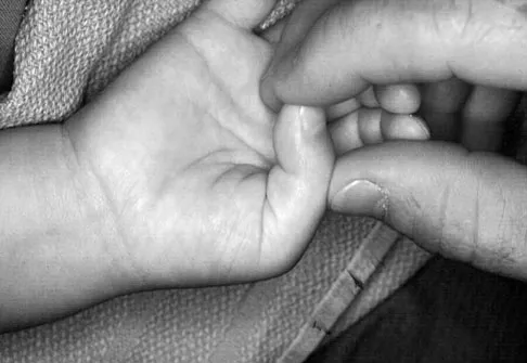 General Orthopedics 2026 Practice Questions: Set 15 (Solved) - Figure 52