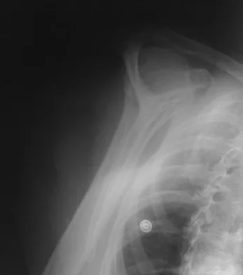 General Orthopedics 2026 Practice Questions: Set 15 (Solved) - Figure 57