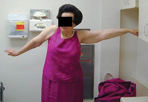 General Orthopedics 2026 Practice Questions: Set 15 (Solved) - Figure 58