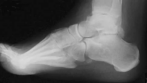 General Orthopedics 2026 Practice Questions: Set 15 (Solved) - Figure 59