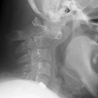General Orthopedics 2026 Practice Questions: Set 15 (Solved) - Figure 6