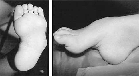 General Orthopedics 2026 Practice Questions: Set 15 (Solved) - Figure 60