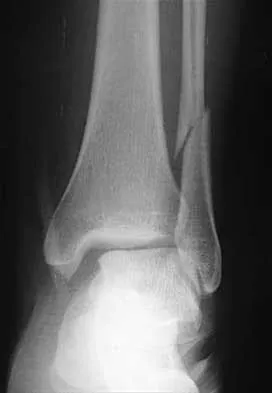 General Orthopedics 2026 Practice Questions: Set 15 (Solved) - Figure 73