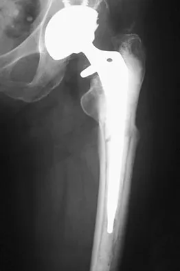 General Orthopedics 2026 Practice Questions: Set 15 (Solved) - Figure 81