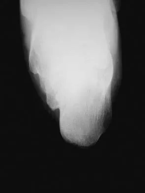 General Orthopedics 2026 Practice Questions: Set 15 (Solved) - Figure 83