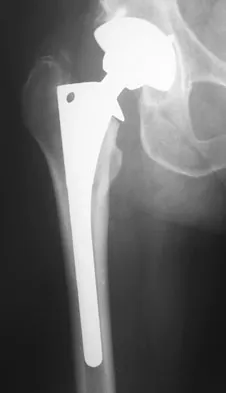 General Orthopedics 2026 Practice Questions: Set 15 (Solved) - Figure 84