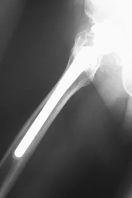 General Orthopedics 2026 Practice Questions: Set 15 (Solved) - Figure 87