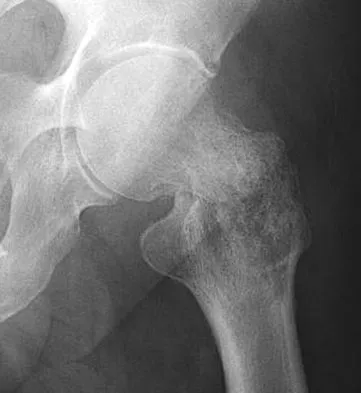 General Orthopedics 2026 Practice Questions: Set 15 (Solved) - Figure 9