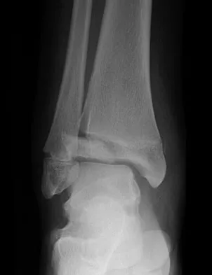 General Orthopedics 2026 Practice Questions: Set 15 (Solved) - Figure 91